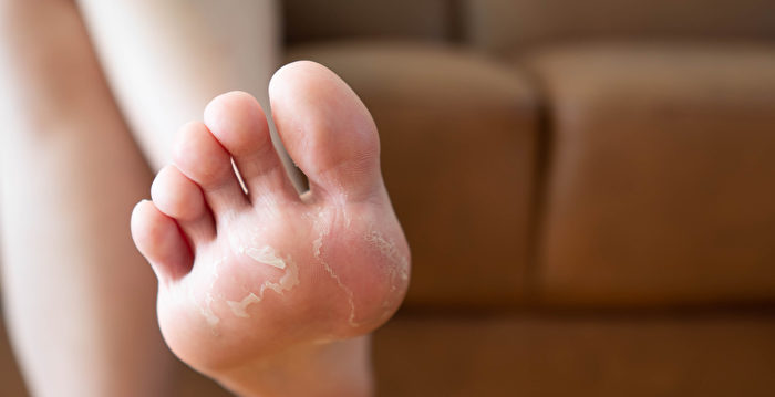 Why Do Your Feet Smell—And How to Get Rid of the Odor