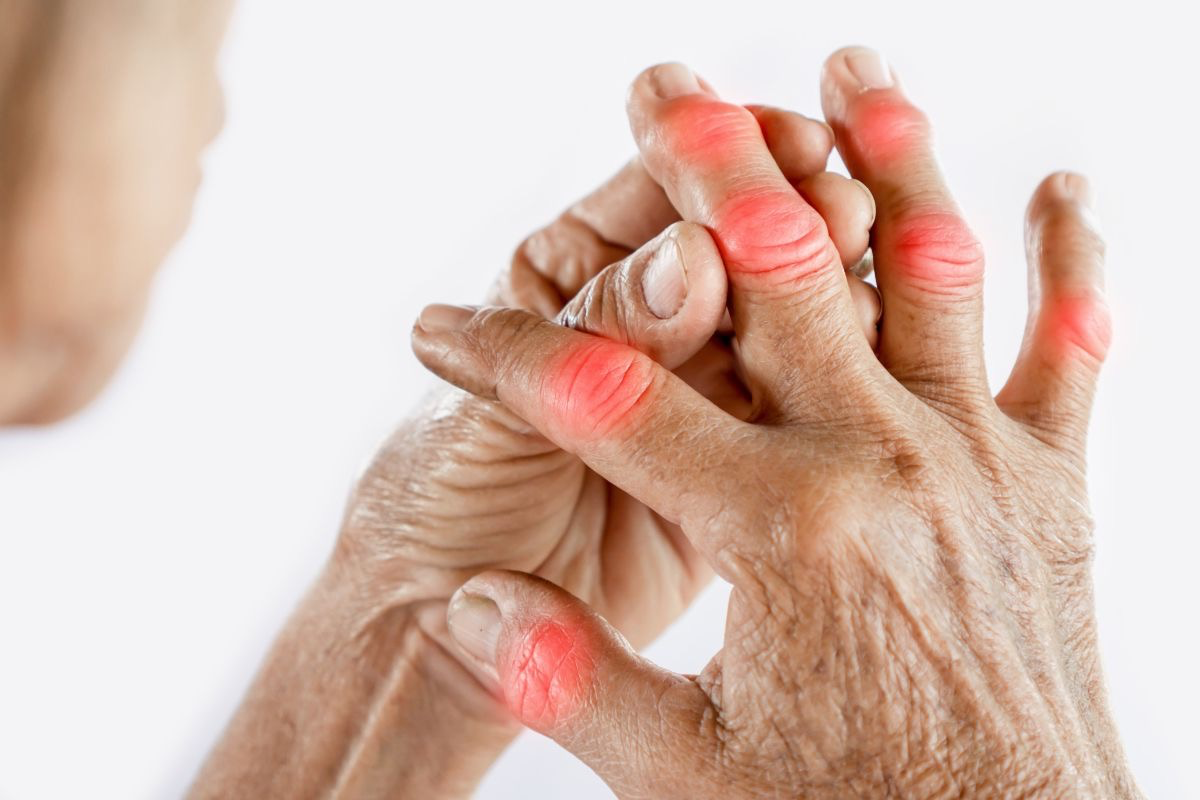 10 Warning Signs of a Rheumatoid Arthritis Flare & Science-Backed Prevention Tips